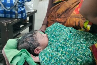 ತಾಲೂಕ ಆಸ್ಪತ್ರೆಯಲ್ಲಿ ವೈದ್ಯರ ಎಡವಟ್ಟು- ಮಗು ಅದಲು ಬದಲು